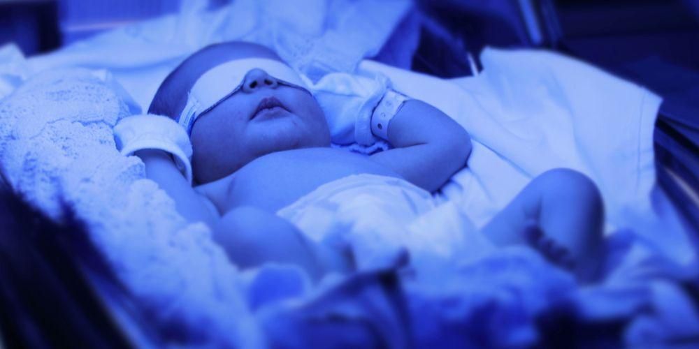 petua turunkan kuning bayi dengan cepat